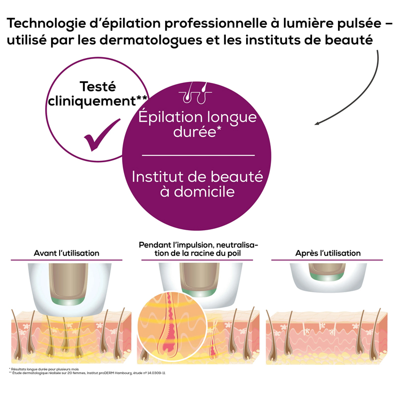 Épilateur BEURER à Lumière Pulsée - Noir (IPL5800) - Image 4